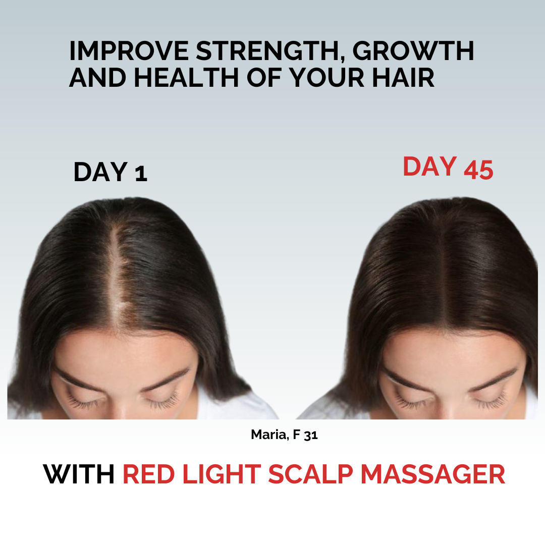 Friendlyglów Raudonos Šviesos Terapijos Skalpo Masažuoklis